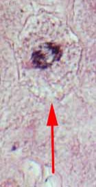 anaphase
