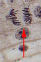 anaphase