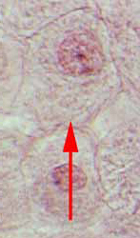 interphase