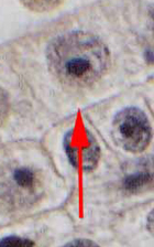 interphase