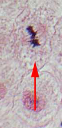 metaphase