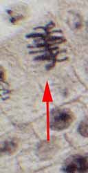 metaphase