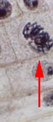 prophase