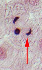 telophase